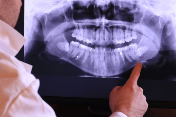 Best Emergency TMJ Treatment in Renville, MN